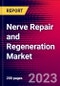 Nerve Repair and Regeneration Market, By Product, By Surgery, and by Region - Global Forecast to 2023-2033 - Product Image