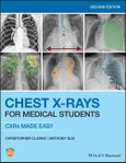Chest X-Rays for Medical Students. CXRs Made Easy. Edition No. 2- Product Image