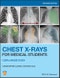 Chest X-Rays for Medical Students. CXRs Made Easy. Edition No. 2 - Product Thumbnail Image