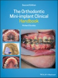 The Orthodontic Mini-implant Clinical Handbook. Edition No. 2- Product Image