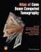 Atlas of Cone Beam Computed Tomography. Edition No. 1 - Product Thumbnail Image
