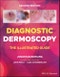 Diagnostic Dermoscopy. The Illustrated Guide. Edition No. 2 - Product Thumbnail Image
