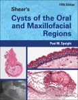 Shear's Cysts of the Oral and Maxillofacial Regions. Edition No. 5- Product Image