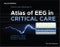Hirsch and Brenner's Atlas of EEG in Critical Care. Edition No. 2 - Product Thumbnail Image