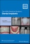 The ADA Practical Guide to Dental Implants. Edition No. 1 - Product Thumbnail Image