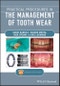 Practical Procedures in the Management of Tooth Wear. Edition No. 1 - Product Thumbnail Image