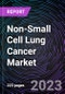 Non-Small Cell Lung Cancer Market by Type, Treatment Type, Distribution Channel, and Geography: Forecast up to 2027 - Product Image