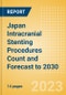 Japan Intracranial Stenting Procedures Count and Forecast to 2030 - Product Thumbnail Image