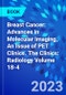 Breast Cancer: Advances in Molecular Imaging, An Issue of PET Clinics. The Clinics: Radiology Volume 18-4 - Product Thumbnail Image
