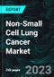 Non-Small Cell Lung Cancer Market, Size, Global Forecast 2023-2030, Industry Trends, Growth, Share, Outlook, Impact of Inflation, Opportunity Company Analysis - Product Image