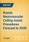 Russia Neurovascular Coiling Assist Procedures Forecast to 2030 - Coiling Assist Balloon and Coiling Assist Stent Procedures - Product Thumbnail Image