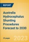 Australia Hydrocephalus Shunting Procedures Forecast to 2030 - Revision Hydrocephalus Shunt and New Hydrocephalus Shunt Procedures - Product Image