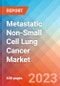 Metastatic Non-Small Cell Lung Cancer - Market Insight, Epidemiology and Market Forecast -2032 - Product Image
