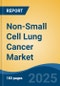 Non-Small Cell Lung Cancer Market - Global Industry Size, Share, Trends, Opportunity, and Forecast, 2020-2030F - Product Image