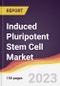 Induced Pluripotent Stem Cell Market Report: Trends, Forecast and Competitive Analysis to 2030 - Product Thumbnail Image