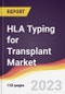 HLA Typing for Transplant Market Report: Trends, Forecast and Competitive Analysis to 2030 - Product Image