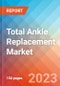 Total Ankle Replacement - Market Insights, Competitive Landscape, and Market Forecast - 2028 - Product Image
