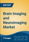 Brain Imaging and Neuroimaging Market - Global Industry Size, Share, Trends, Opportunity, and Forecast, 2018-2028F - Product Thumbnail Image