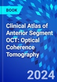 Clinical Atlas of Anterior Segment OCT: Optical Coherence Tomography- Product Image