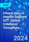 Clinical Atlas of Anterior Segment OCT: Optical Coherence Tomography - Product Image