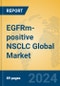 EGFRm-positive NSCLC Global Market Insights 2024, Analysis and Forecast to 2029, by Market Participants, Regions, Technology, Product Type - Product Thumbnail Image