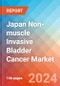 Japan Non-muscle Invasive Bladder Cancer - Market Insights, Epidemiology, and Market Forecast - 2032 - Product Thumbnail Image
