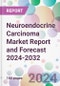 Neuroendocrine Carcinoma Market Report and Forecast 2024-2032 - Product Image