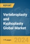 Vertebroplasty and Kyphoplasty Global Market Report 2024 - Product Thumbnail Image