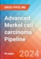 Advanced Merkel cell carcinoma - Pipeline Insight, 2024 - Product Image