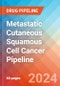 Metastatic Cutaneous Squamous Cell Cancer - Pipeline Insight, 2024 - Product Image