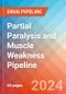 Partial Paralysis and Muscle Weakness - Pipeline Insight, 2024 - Product Image