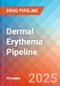 Dermal Erythema - Pipeline Insight, 2024 - Product Thumbnail Image