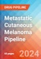 Metastatic Cutaneous Melanoma - Pipeline Insight, 2024 - Product Thumbnail Image