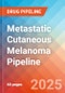 Metastatic Cutaneous Melanoma - Pipeline Insight, 2024 - Product Thumbnail Image