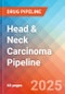 Head & Neck Carcinoma - Pipeline Insight, 2024 - Product Image