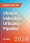 Chronic Inducible Urticaria - Pipeline Insight, 2024 - Product Image