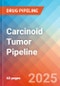 Carcinoid Tumor - Pipeline Insight, 2024 - Product Image