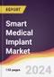 Smart Medical Implant Market Report: Trends, Forecast and Competitive Analysis to 2030 - Product Thumbnail Image
