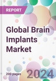Global Brain Implants Market- Product Image