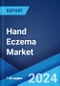 Hand Eczema Market: Epidemiology, Industry Trends, Share, Size, Growth, Opportunity, and Forecast 2024-2034 - Product Thumbnail Image