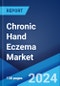 Chronic Hand Eczema Market: Epidemiology, Industry Trends, Share, Size, Growth, Opportunity, and Forecast 2024-2034 - Product Image