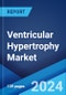 Ventricular Hypertrophy Market: Epidemiology, Industry Trends, Share, Size, Growth, Opportunity, and Forecast 2024-2034 - Product Image