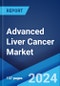 Advanced Liver Cancer Market: Epidemiology, Industry Trends, Share, Size, Growth, Opportunity, and Forecast 2024-2034 - Product Image