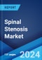 Spinal Stenosis Market: Epidemiology, Industry Trends, Share, Size, Growth, Opportunity, and Forecast 2024-2034 - Product Image