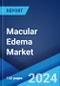 Macular Edema Market: Epidemiology, Industry Trends, Share, Size, Growth, Opportunity, and Forecast 2024-2034 - Product Image