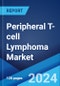 Peripheral T-cell Lymphoma Market: Epidemiology, Industry Trends, Share, Size, Growth, Opportunity, and Forecast 2024-2034 - Product Thumbnail Image