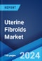 Uterine Fibroids Market: Epidemiology, Industry Trends, Share, Size, Growth, Opportunity, and Forecast 2024-2034 - Product Image