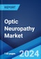 Optic Neuropathy Market: Epidemiology, Industry Trends, Share, Size, Growth, Opportunity, and Forecast 2024-2034 - Product Image