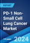 PD-1 Non-Small Cell Lung Cancer Market: Epidemiology, Industry Trends, Share, Size, Growth, Opportunity, and Forecast 2024-2034 - Product Image