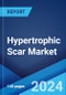 Hypertrophic Scar Market: Epidemiology, Industry Trends, Share, Size, Growth, Opportunity, and Forecast 2024-2034 - Product Thumbnail Image